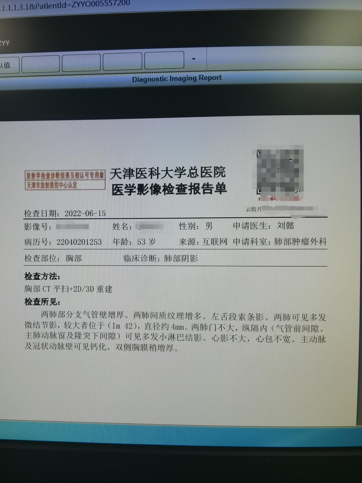 刘懿博士说肺癌治疗药,刘懿谈肺癌治疗方案