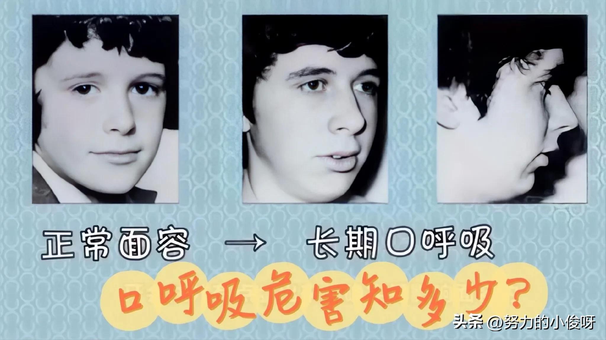 改善嘴凸的呼吸法,改善嘴凸的物理方法
