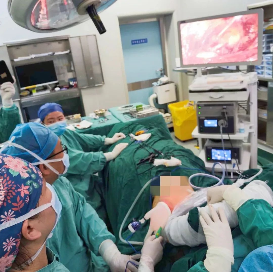 微创腹腔镜手术,腹腔镜微创手术