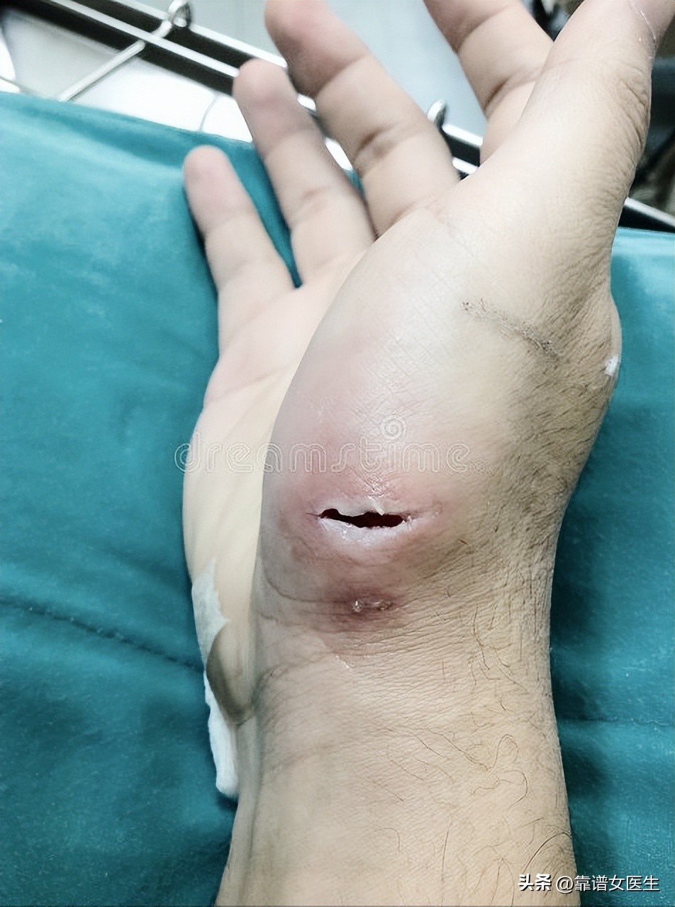 女子被狗狗咬伤面部,女子被狗狗咬伤脸后续