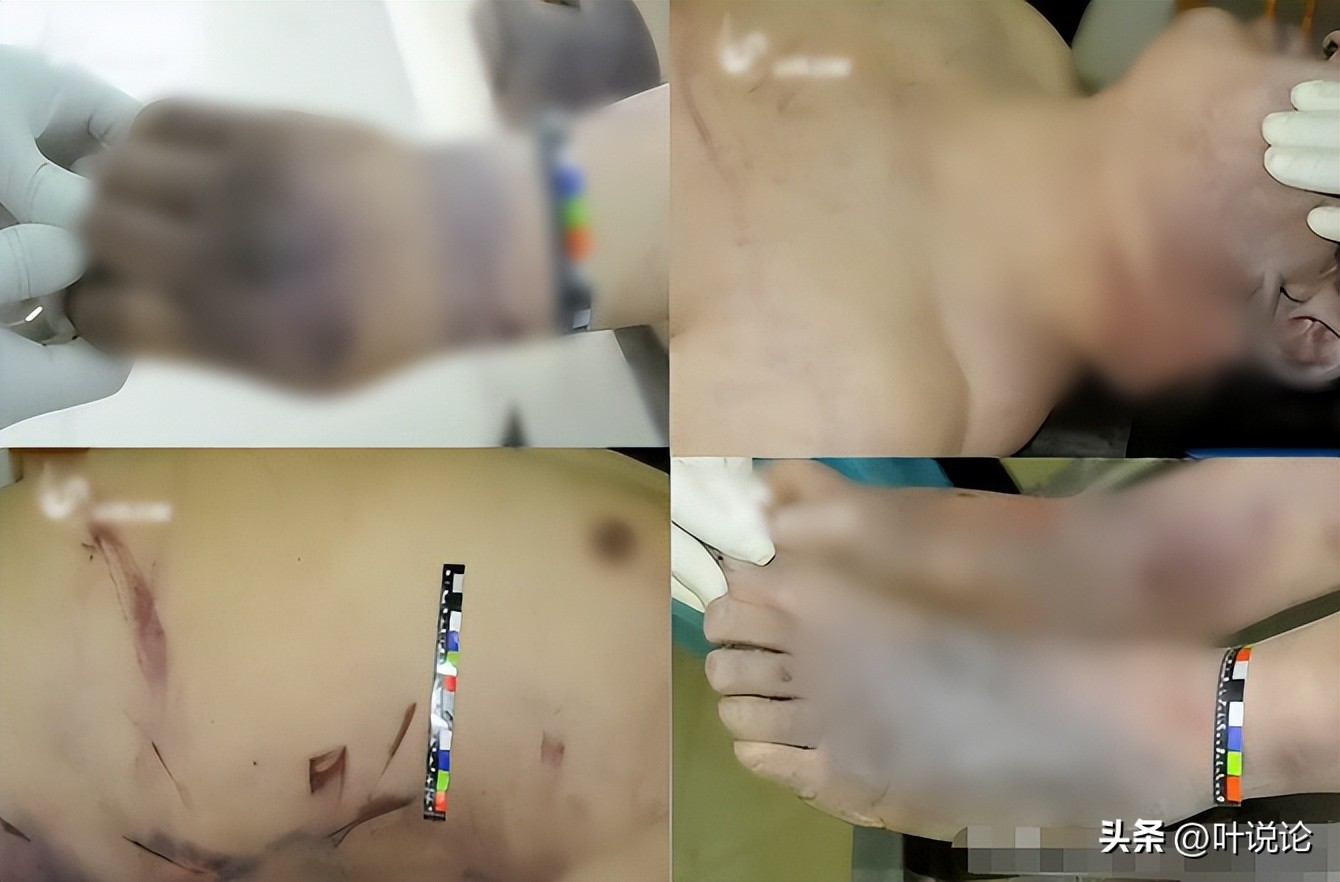 丈夫欠巨款被妻子打死最新消息,丈夫毒打妻儿25年瘫痪无人管