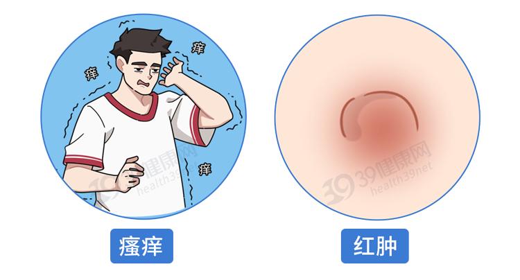 阿莫西林是好药但只对四种病有效,阿莫西林别滥用只针对这六种病