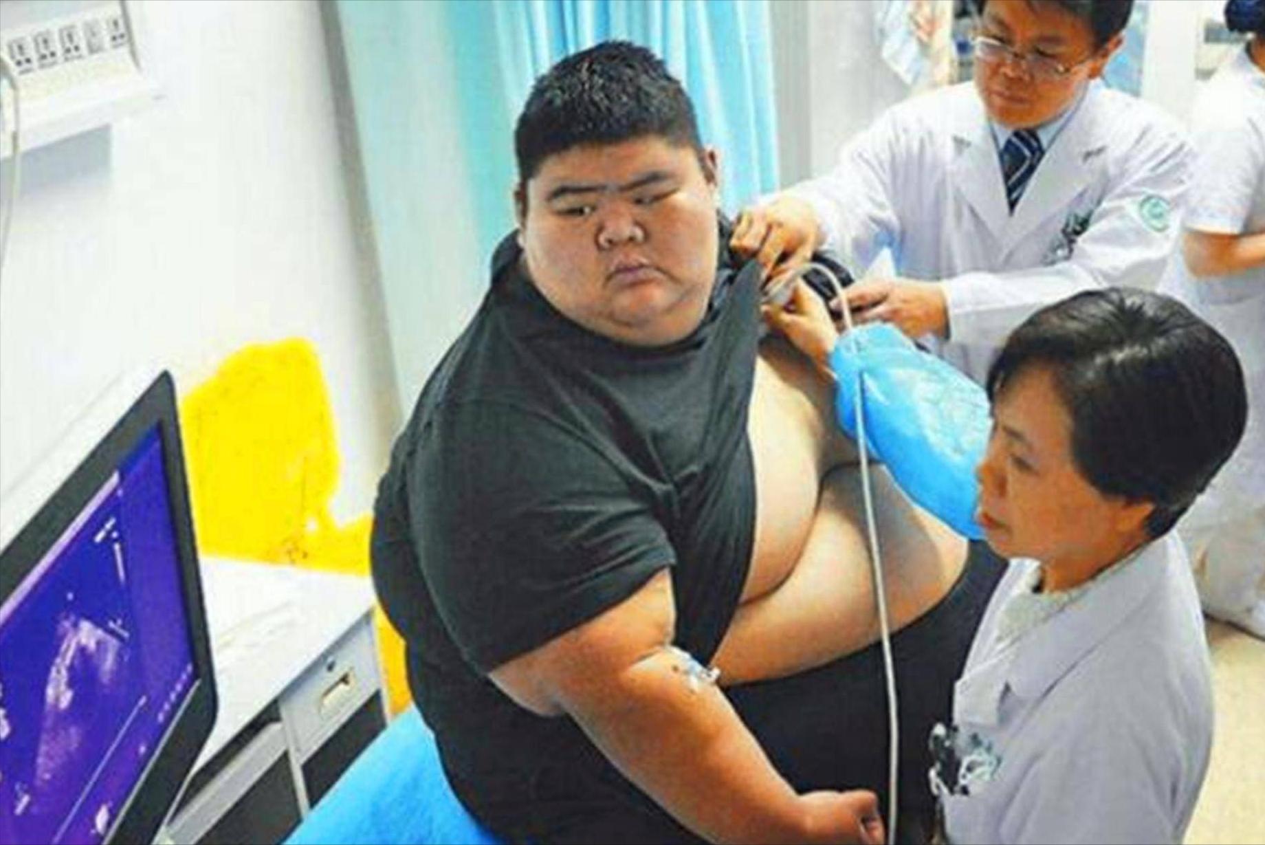 减肥400斤王浩楠照片,山东减肥小伙王浩楠现状