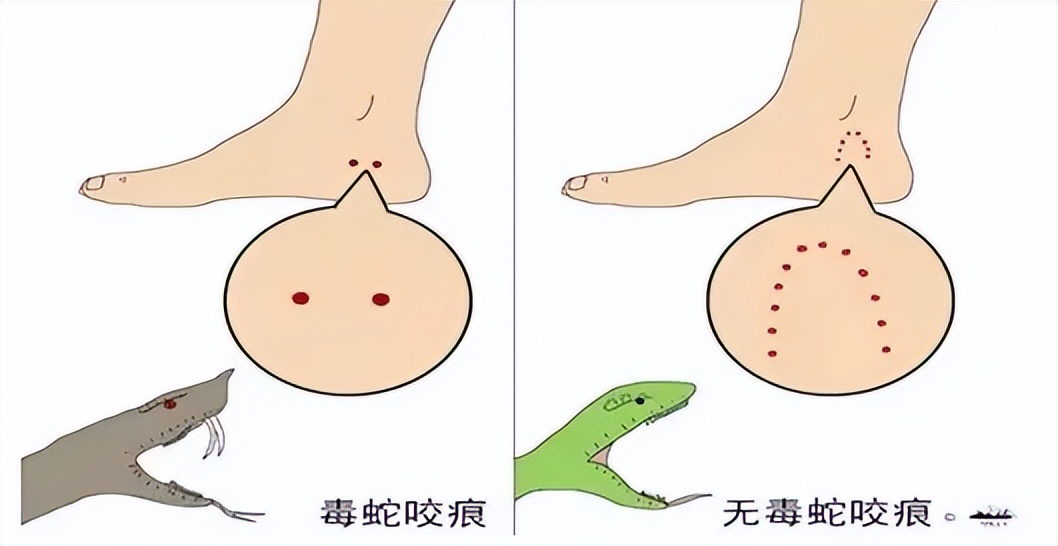 极度崩溃！江西老人在被窝里摸到蛇，如何才能驱蛇？雄黄真的没用