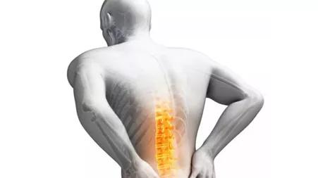 腰椎间盘突出微创术,中央型腰椎间盘突出