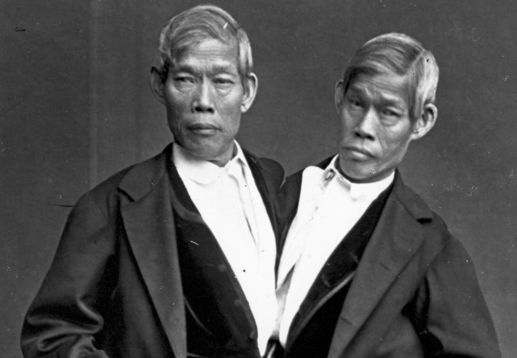 邦克兄弟连体人,连体人怎么进行生育