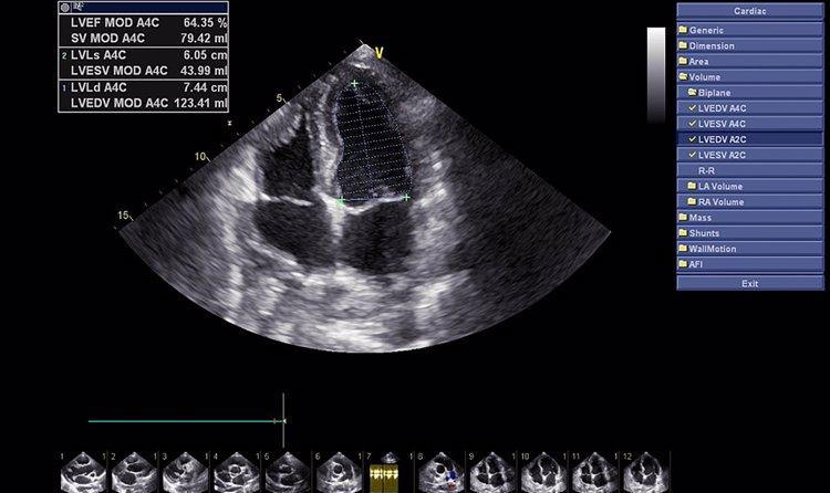 女生体检妇科一般注意什么,28岁女性体检要做哪些必要项目