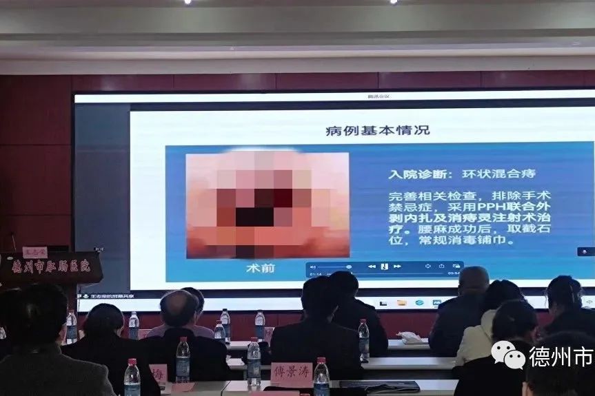 消痔灵注射术往哪里打,消痔灵注射术