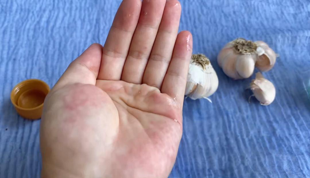 白醋放手上搓一搓有什么用,白醋倒在手心里有什么作用