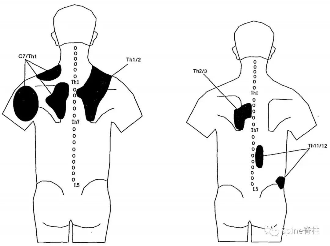脊柱神经支配疼痛区域,脊柱神经支配的脏腑