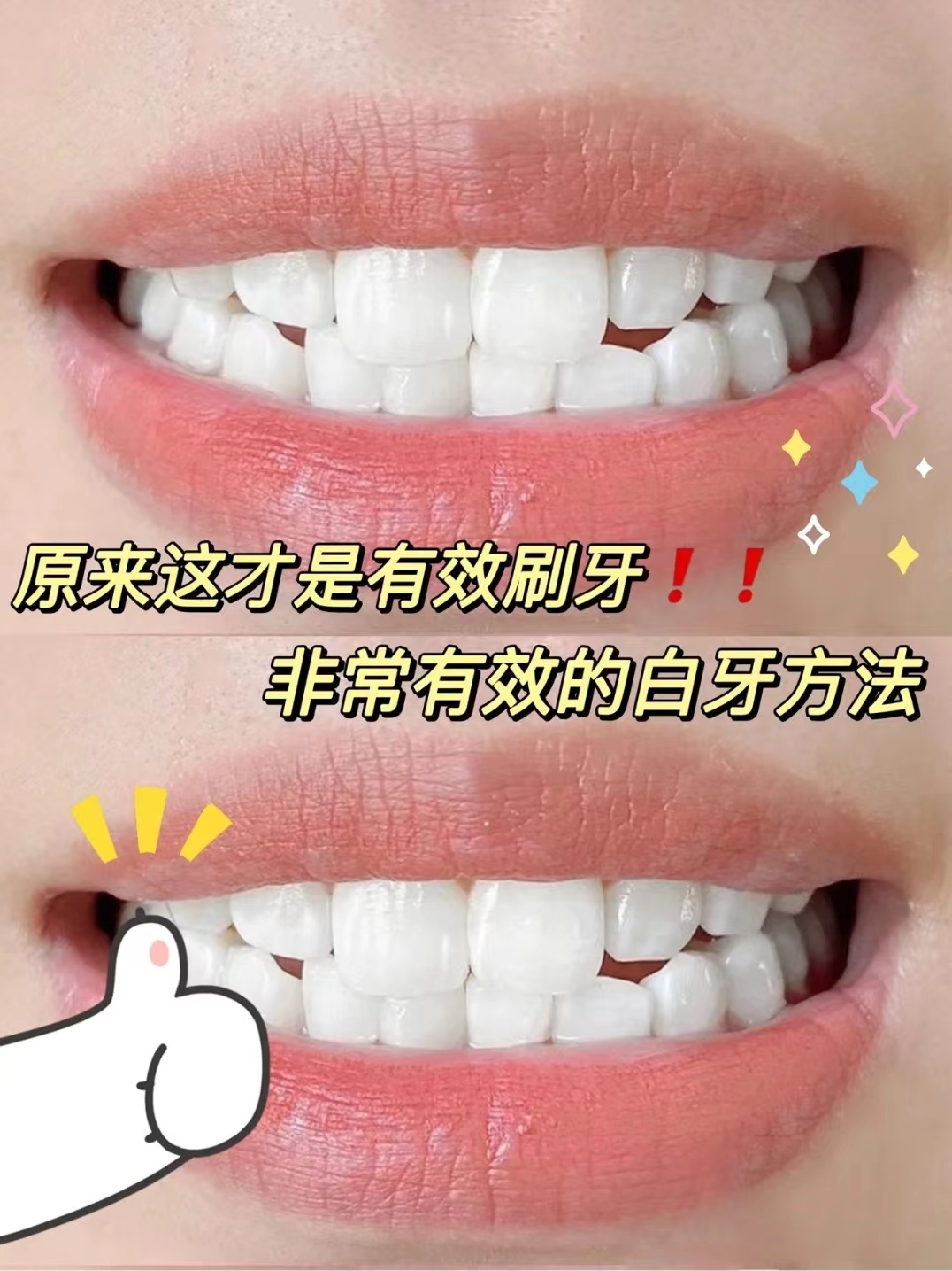 姐妹们我试过了,这玩意儿去牙黄也太牛了吧!轻松实现口香齿白!