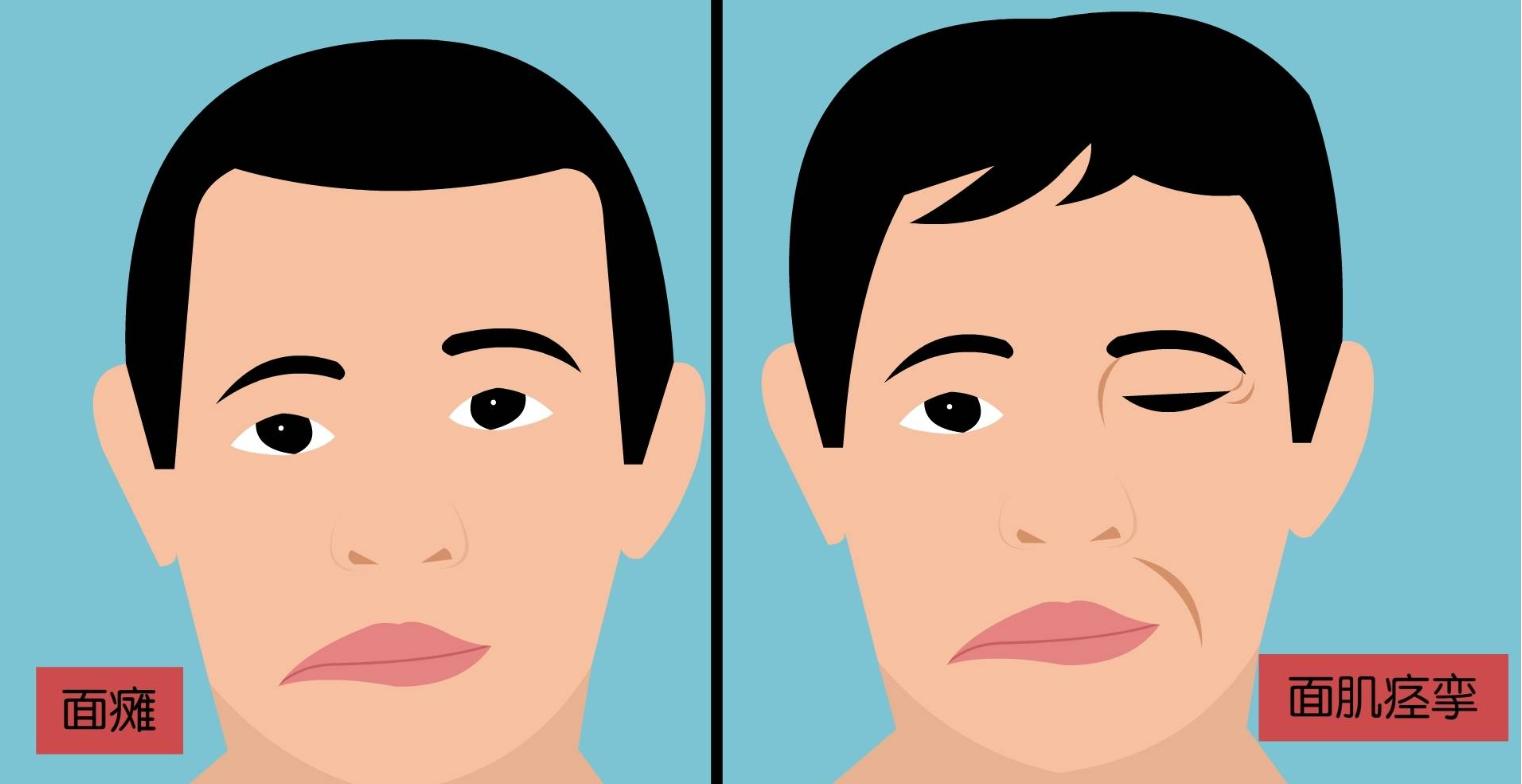 睡觉流口水要警惕四种疾病,睡觉流口水是什么病的前兆