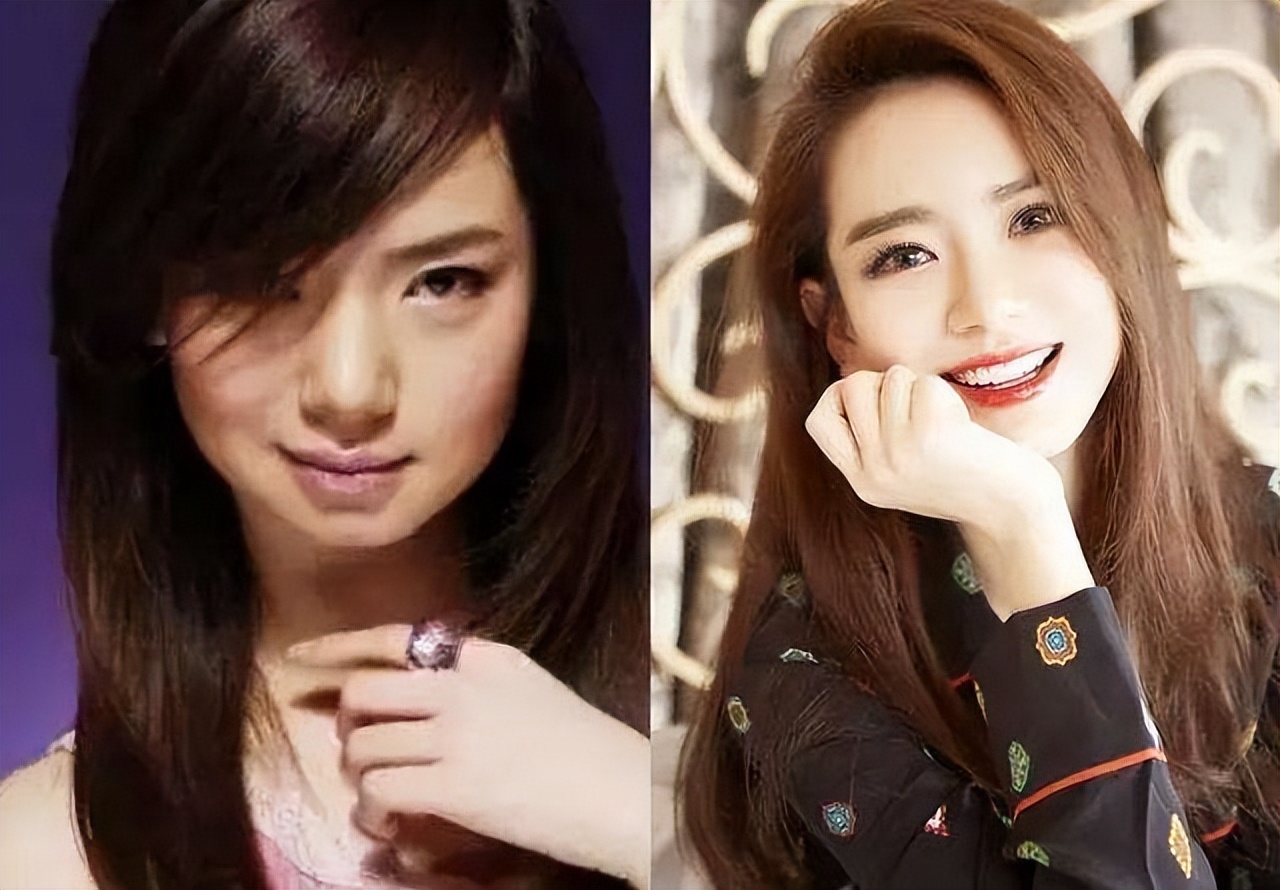 最近哪个明星割双眼皮前后对比,明星一般都做什么样的双眼皮