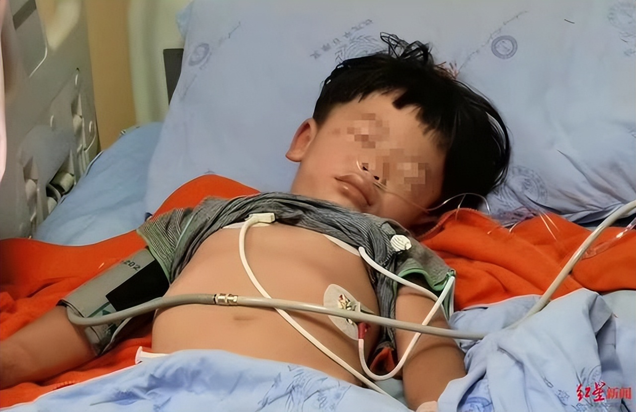 红火蚁咬伤人事件,小孩被红火蚁咬死亡