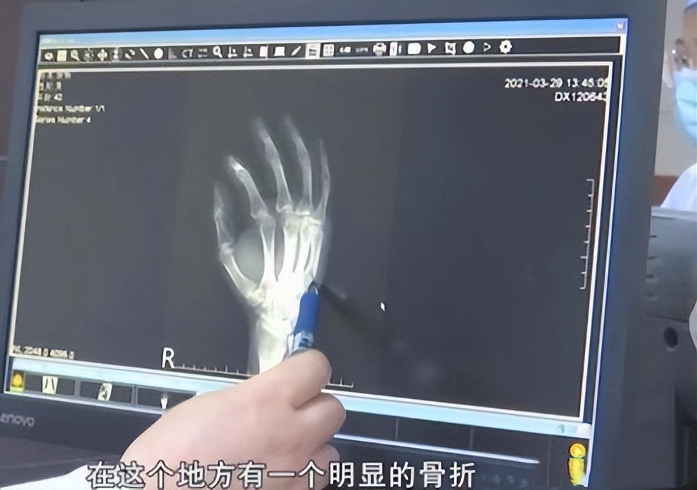 父亲拍断手骨,这得生多大的气?他为何怒发冲冠?一问,憋不住笑