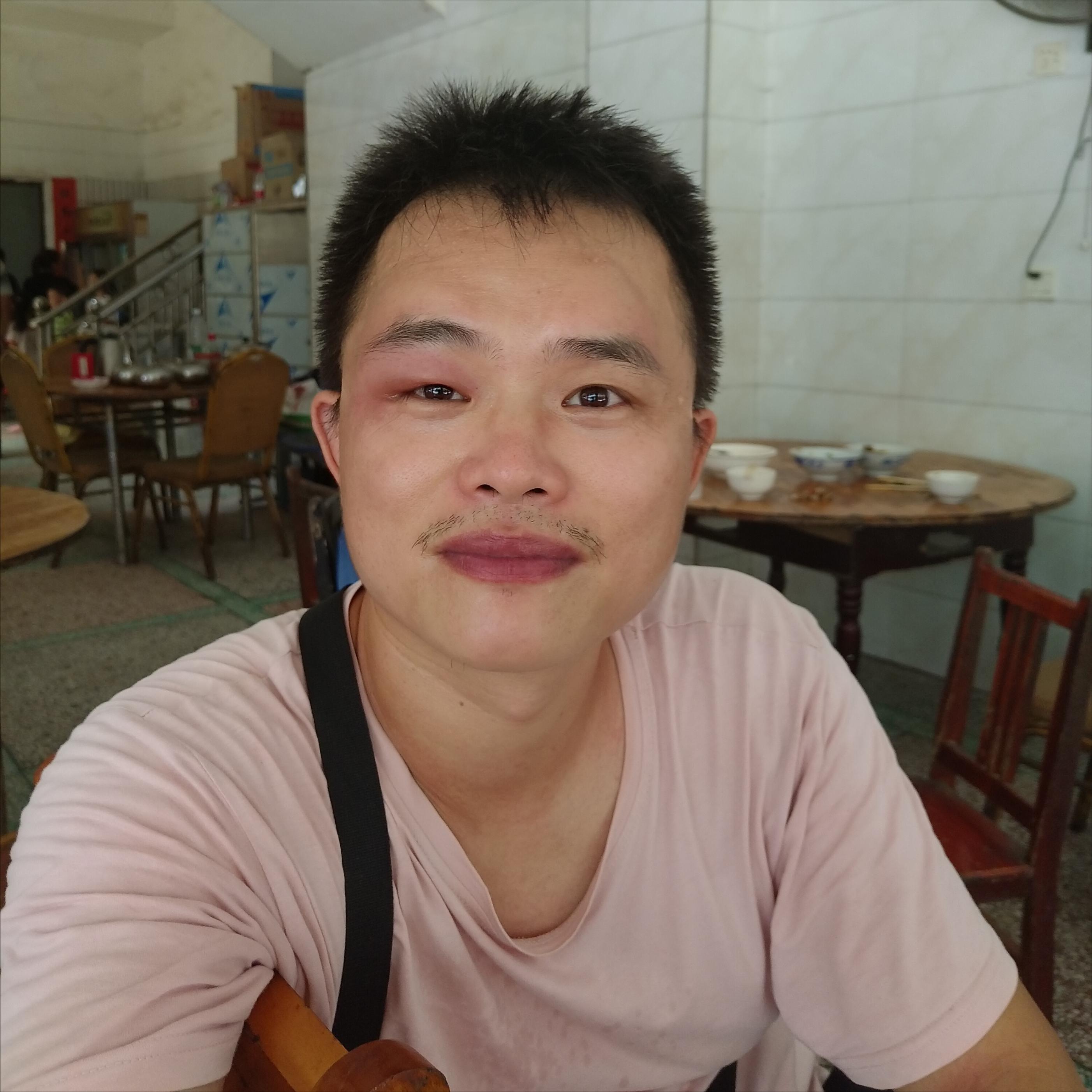 蜜蜂蛰了额头留下一片黑怎么办,我被蜜蜂蛰了