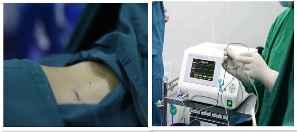 针尖上的艺术,针尖上的艺术效果