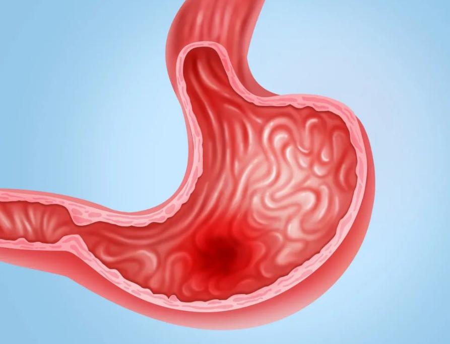 警惕这8种梦可能真的是疾病征兆,睡眠一直做梦可能是什么病