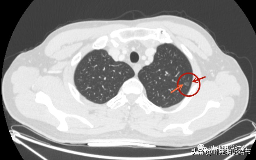 医生为了预防医患矛盾过度诊疗,医院过度医疗手术