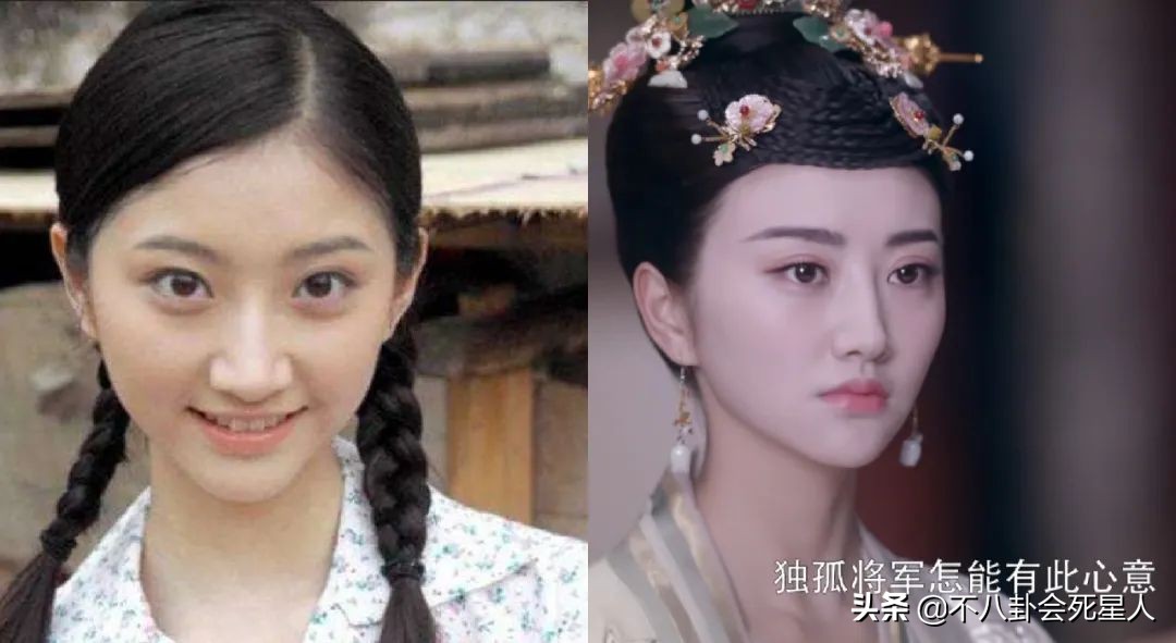 景甜悲伤蛙双眼皮照片,明星割双眼皮前后对比图