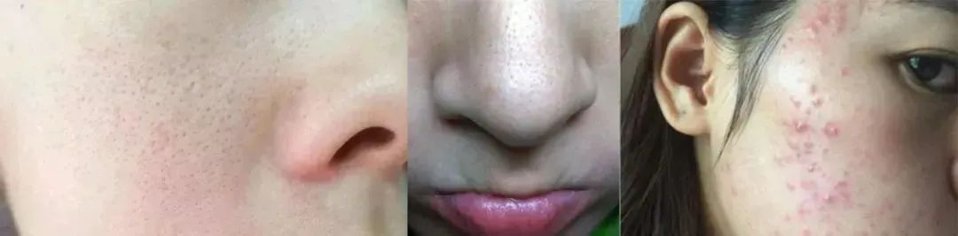 敏感肌亲妈大牌护肤品,敏感皮亲妈洗面奶