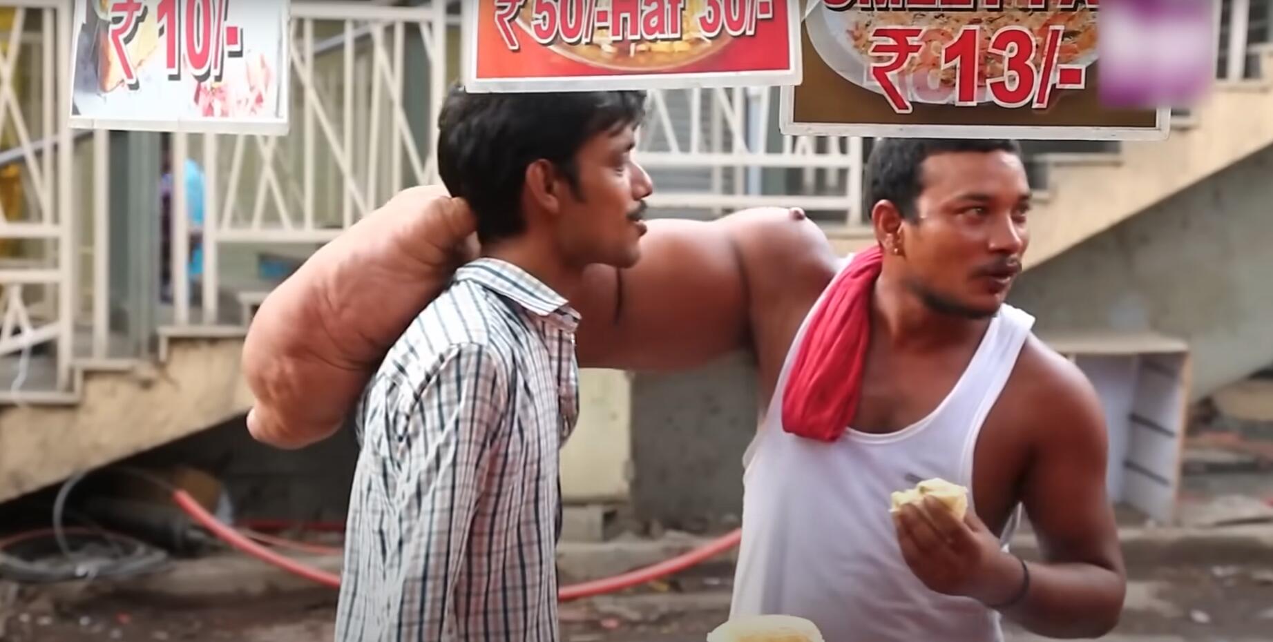 10个难以置信的人类，树皮人、外星人、拥有粗壮手臂的大力水手