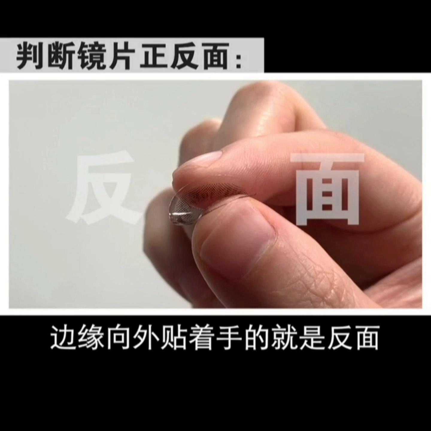 隐形牙套变美过程,隐形矫正变美