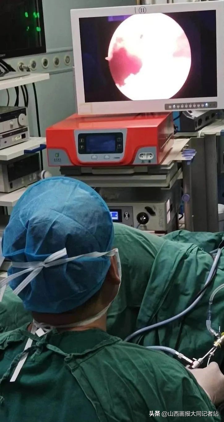 前列腺蒸汽消融手术经历,前列腺蒸汽微创手术哪里可以做