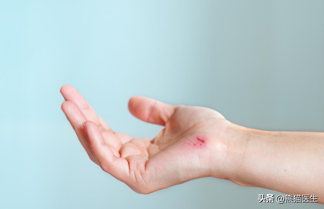 创口贴和创可贴用错会怎么样,创口贴和创可贴用错的后果