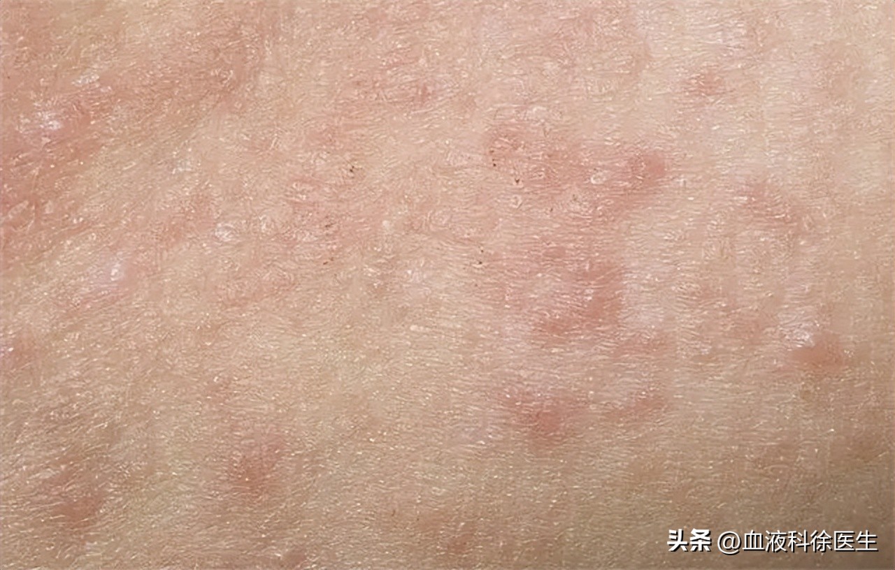 使用润滑剂,对夫妻的身体有害吗?怎样用才好?一文讲清楚