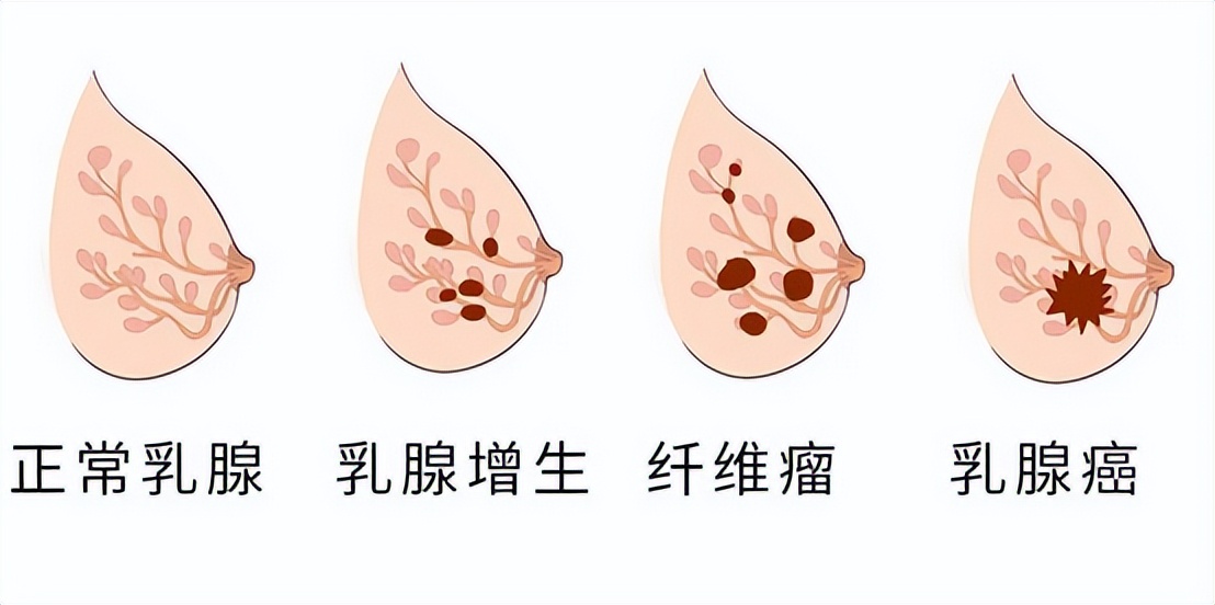 胸部长的褐色小点是什么,女生胸部上长了白色小点点