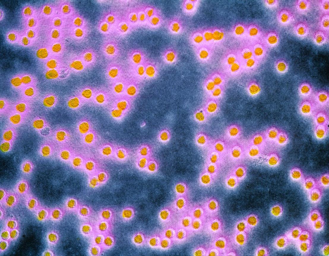 派特生物治疗hpv阳性可以吗,派特灵能祛除hpv病毒吗可以转阴吗