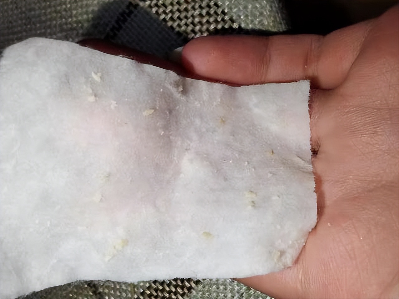 额头眉心发红有闭口粉刺,眉心鼻头频繁起粉刺怎么办