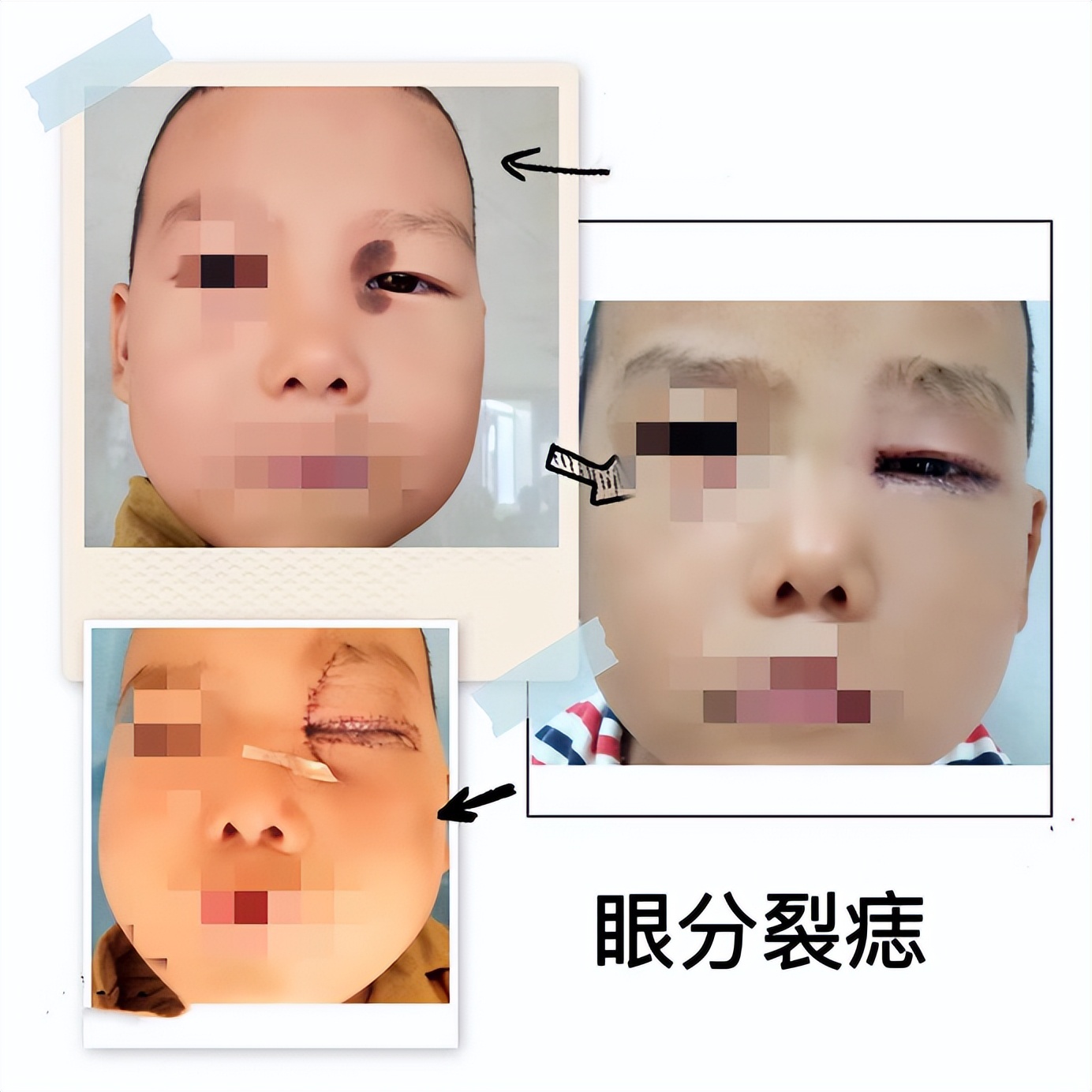 医疗美容变美秘诀,美容科医生教你悄悄变美