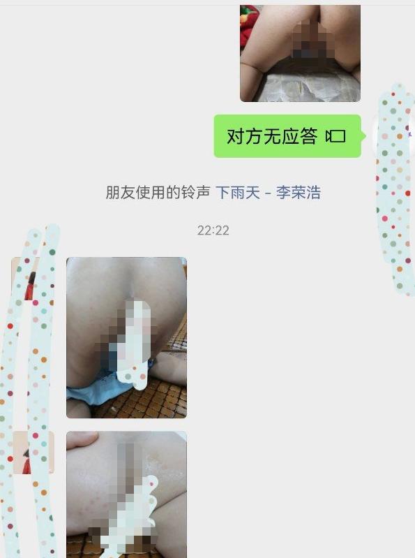 去海边游泳回来全身刺痛,去海边玩后皮肤浮现红点还痒图片