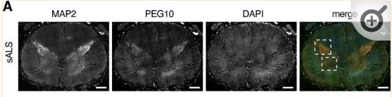 NPF2.8促进因子对拟南芥花粉表面黄酮醇糖苷积累作用的研究