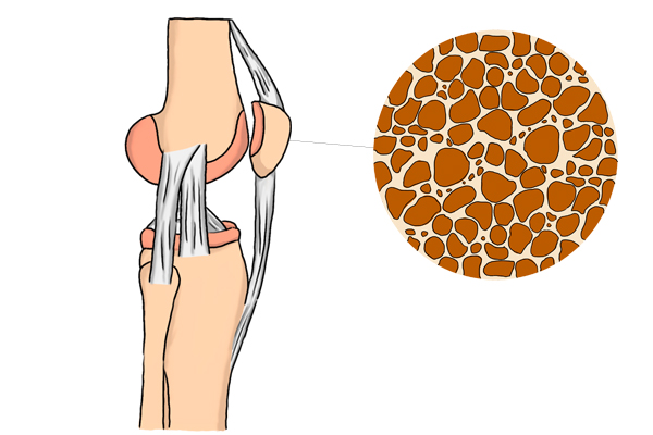 封闭针就是激素药吗,封闭针是治病的吗