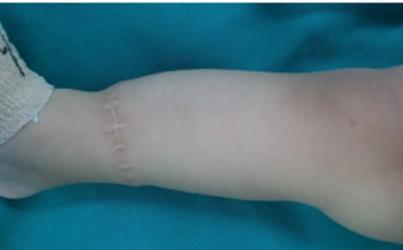 抗击疫情硬核技术,抗击疫情中的尖端技术