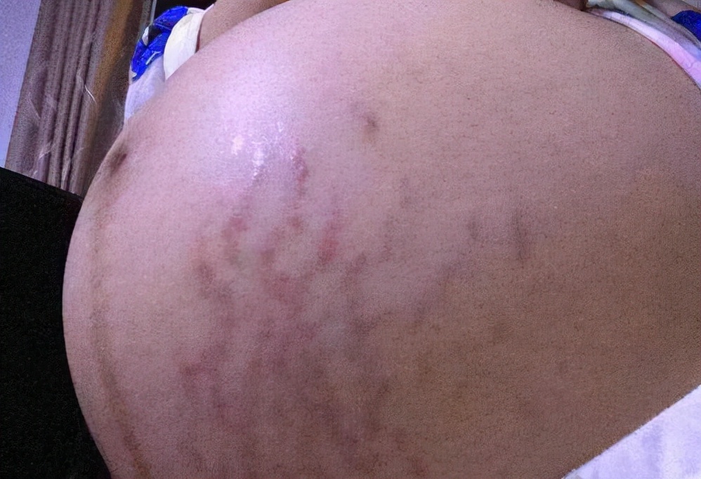 怀孕25周左右的宝宝,孕二十五周胎儿跟什么一样大