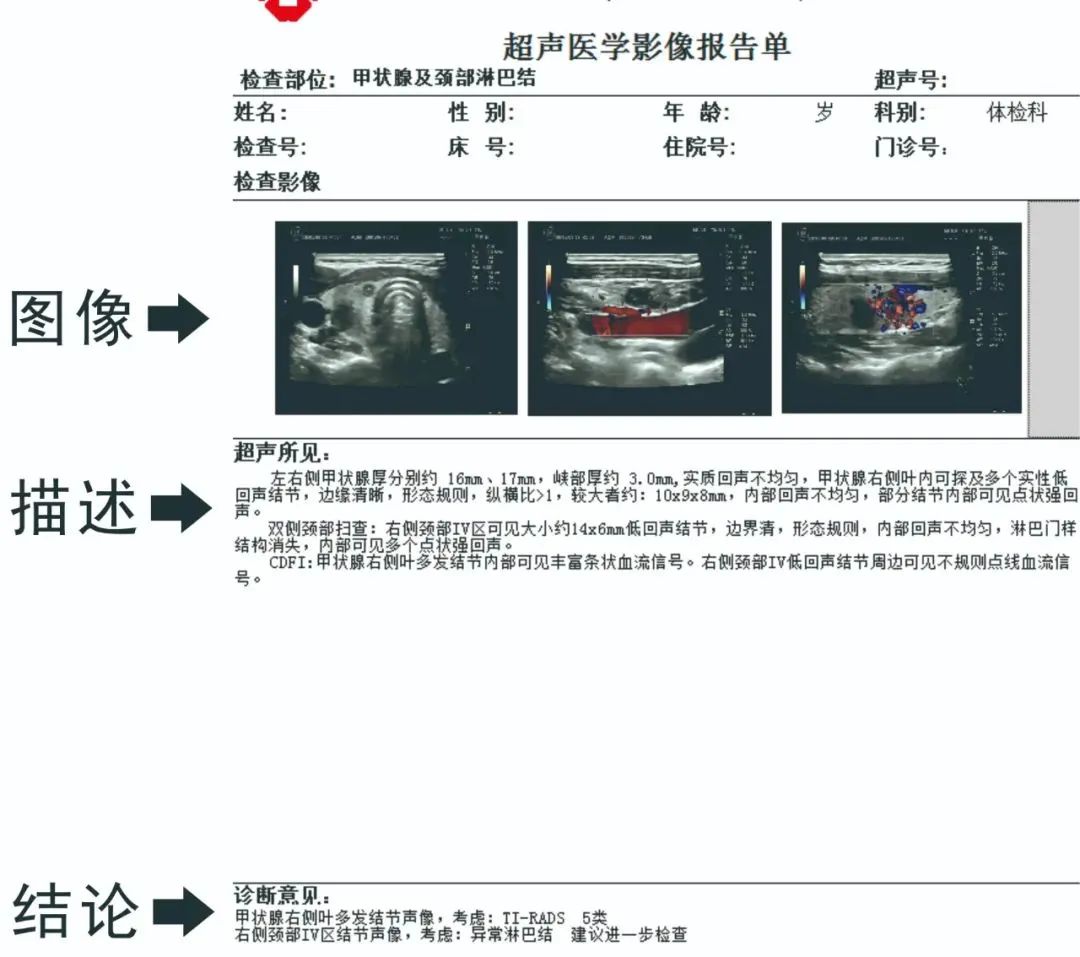 保护甲状腺（二）丨带你读懂甲状腺检查报告解析