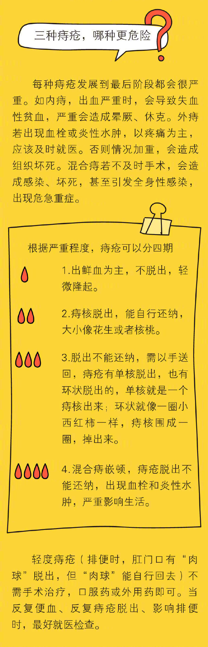微创痔疮手术后的护理流程,痔疮肉球手术的操作流程