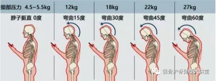 科普腰肌劳损到底是怎么回事,颈肩肌肉劳损引起的疼痛怎么治疗