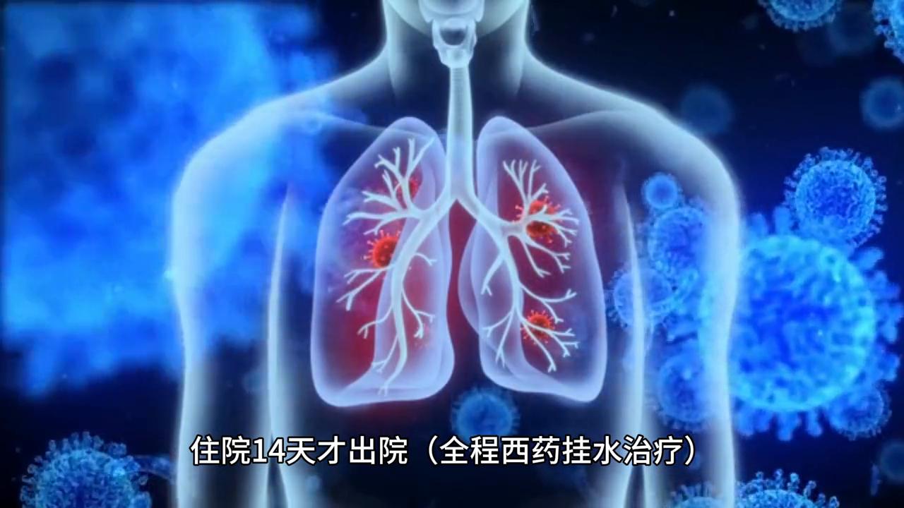 得了支原体感染，试着中西医结合。#中医#传统文化#支原体肺炎