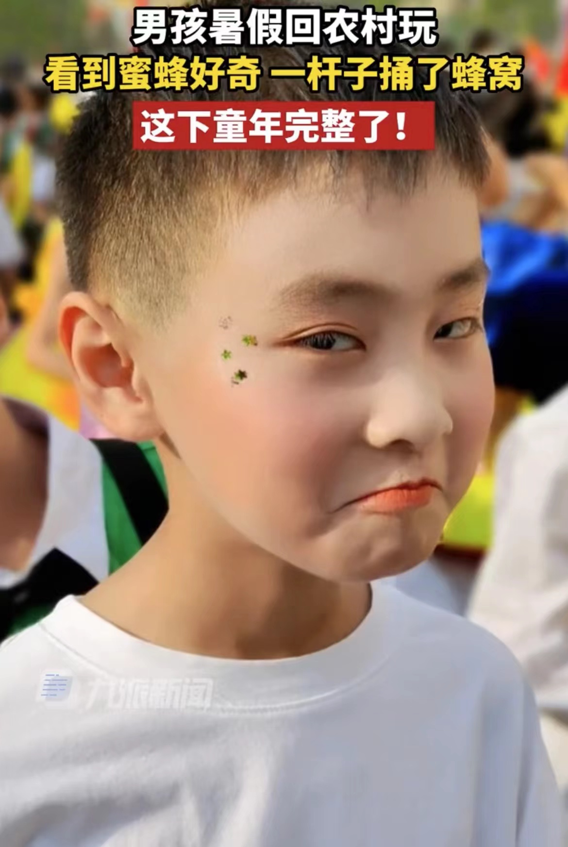 喜提完整童年！男孩好奇捅蜂窝被蜜蜂蛰，网友：亲妈都不认识他了