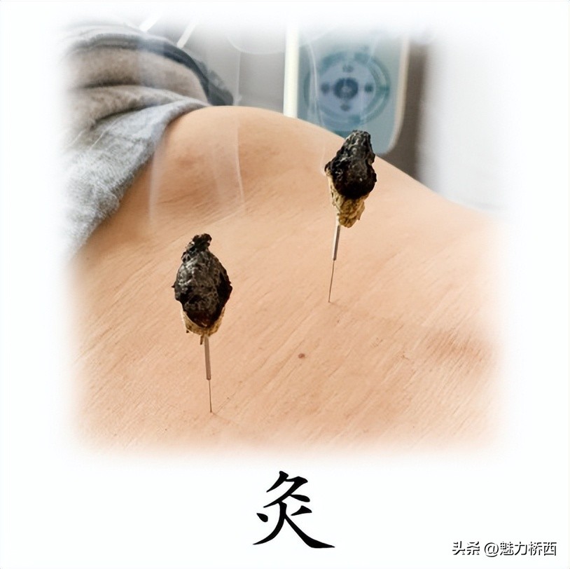 阳康之后头痛怎么办,阳康之后一直头疼是怎么回事