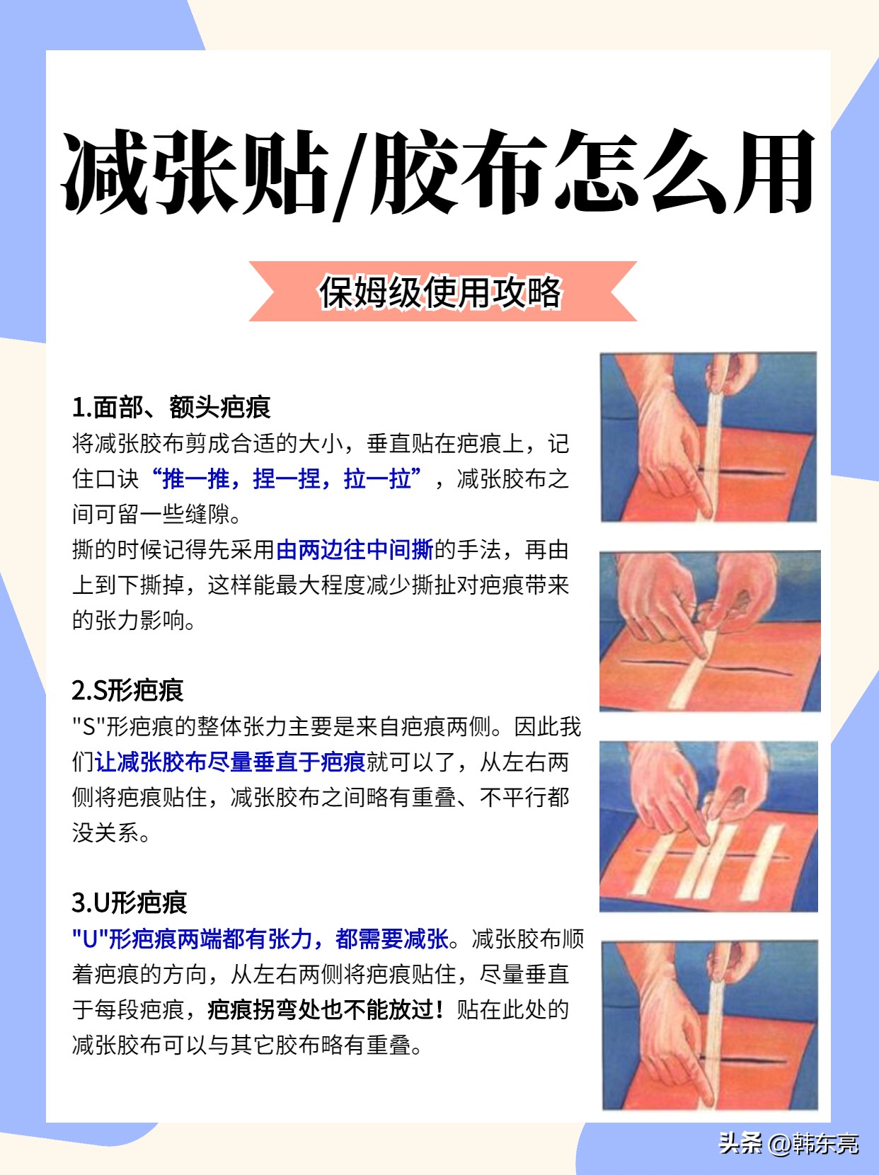 疤痕贴和减张器哪个好,疤痕减张器贴错了