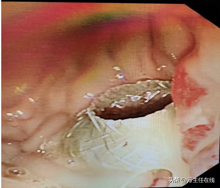 上海市儿童医学中心消化科,上海第一人民医院消化科万荣教授