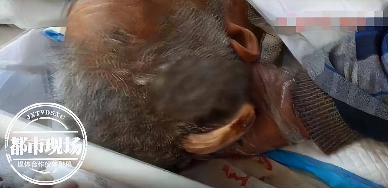 112岁老人头上长犄角,107岁老人头上有个长犄角