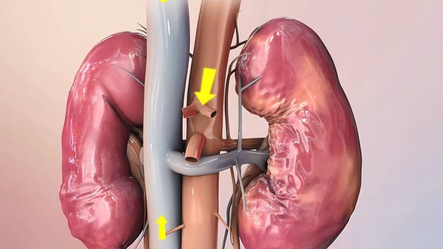 肾病突破性治疗的新药,肾病新药