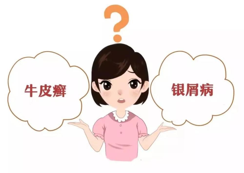 银屑病易与哪些皮肤病混淆,银屑病在人群中的比例